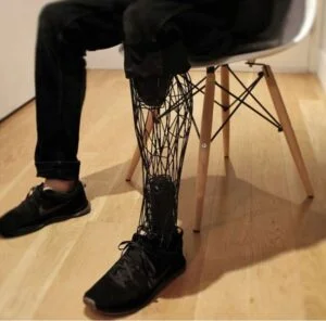 Prótesis de pierna impresa en 3D