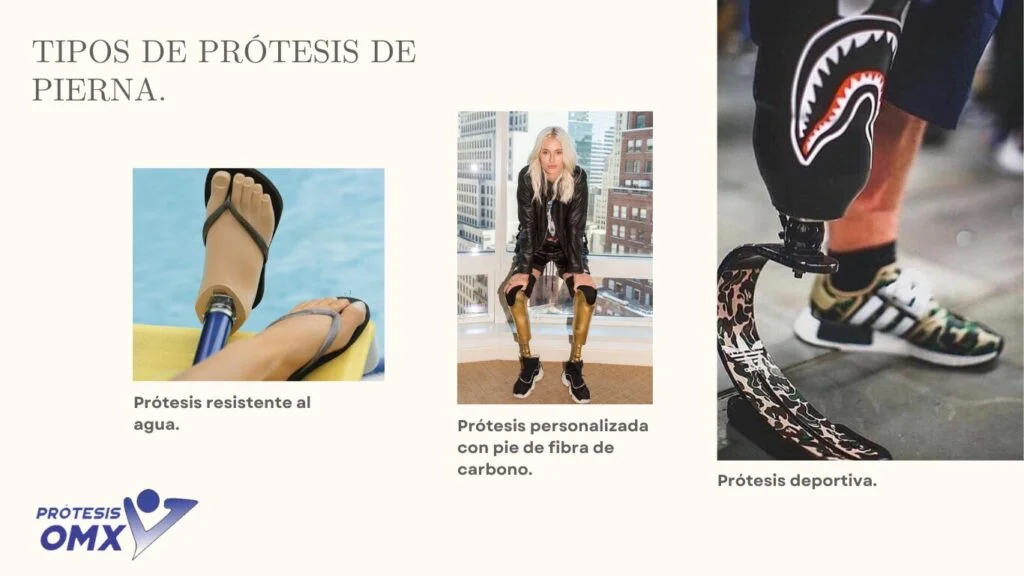 Los Diferentes Tipos de Prótesis de Pierna y Cómo Elegir la Adecuada